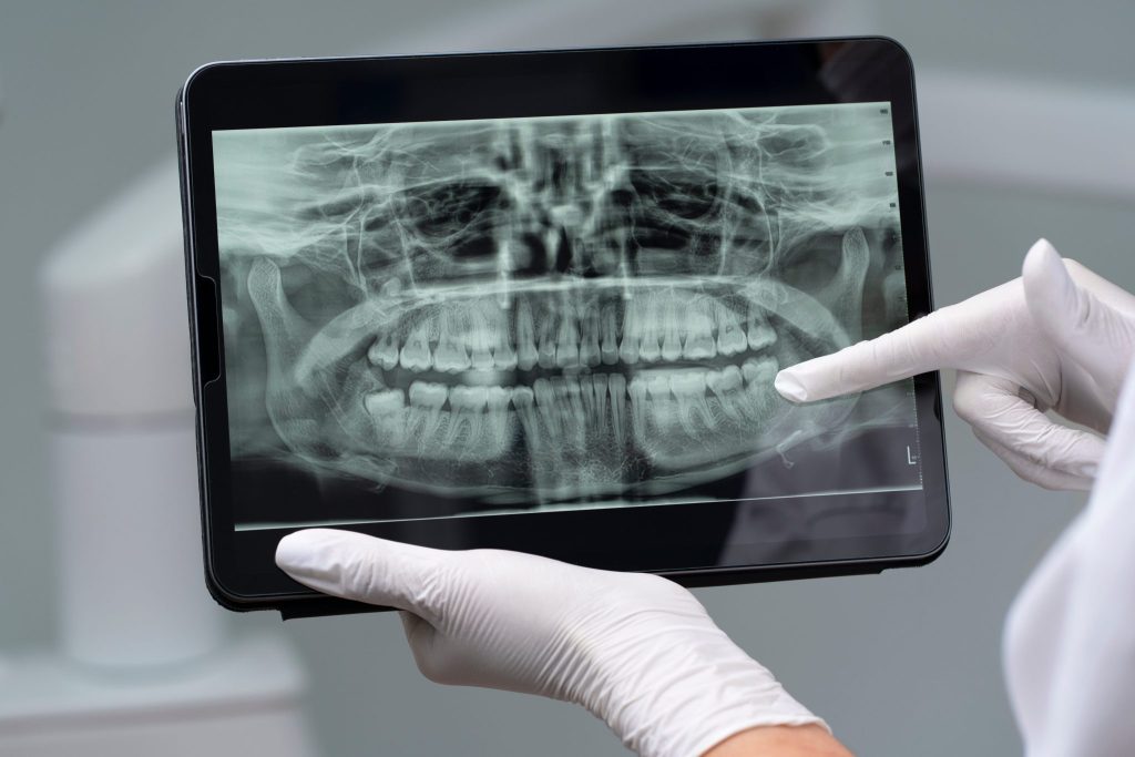 Radiografía para cirugía maxilofacial